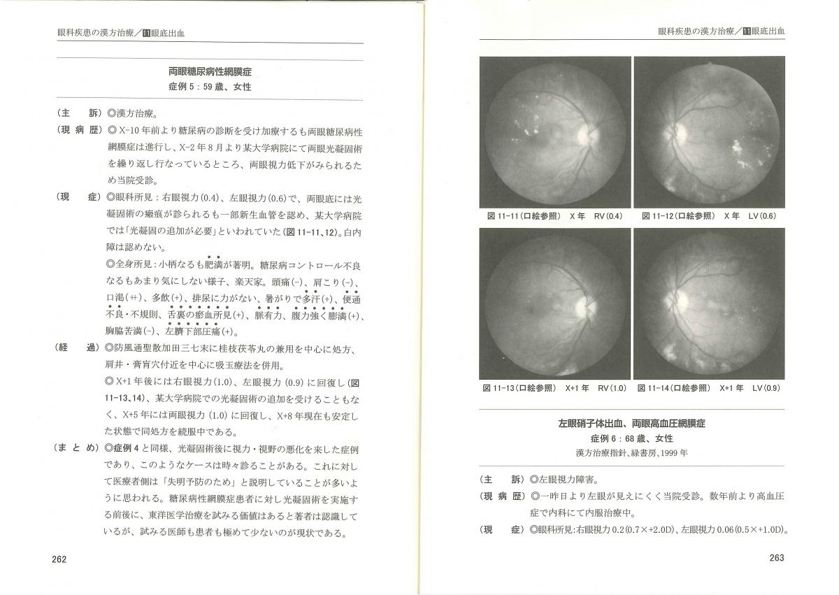 株式会社メディカルユーコン　漢方眼科診療35年―眼疾患に漢方は効く―